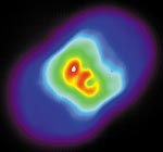 Infrared image of Eta Carinae